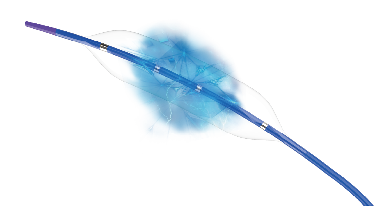 冲击波球囊导管